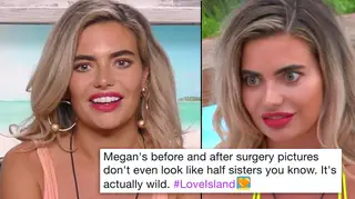 Megan Love Island Plastic Surgery Before After