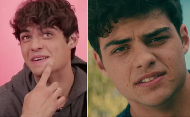 Noah Centineo Just Shared The Story Of How He Got His Face Scar - PopBuzz