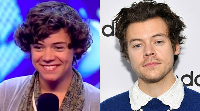 Harry Styles: Then vs. Now