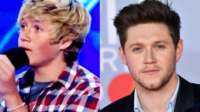 Niall Horan: Then vs. Now
