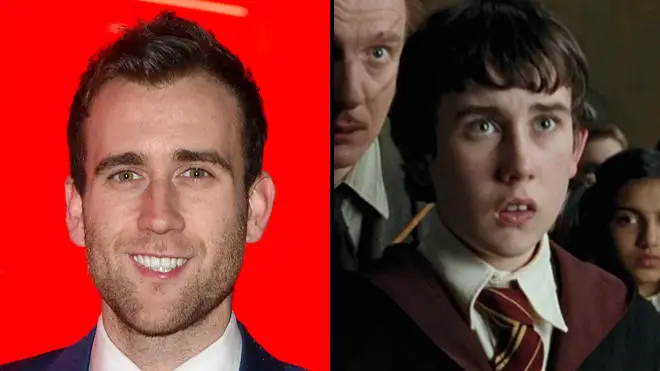 Neville Longbottom actor had to wear "vile" cheek-padding in Harry Potter after losing weight