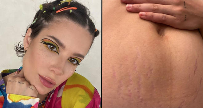 Halsey praised for showing off their stretch marks after welcoming baby Ender