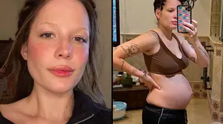 Halsey shares photos of her body after giving birth to combat postpartum body stigma