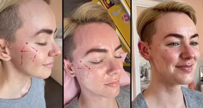 People are getting their zodiac sign constellations tattooed on as freckles