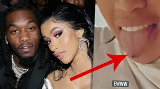 Cardi B just ate her husband Offset's scab and the internet is disgusted