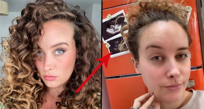 Skins actress April Pearson reveals she's pregnant