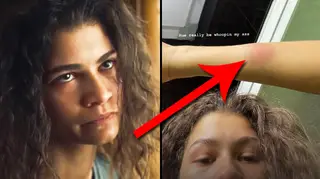 Zendaya still has "scars and bruises" after filming Rue's intervention in Euphoria