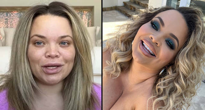 Trisha Paytas defends their decision to use OnlyFans while pregnant following backlash