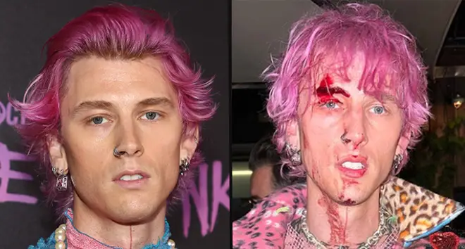 Machine Gun Kelly reveals why he smashed a champagne glass in his own face
