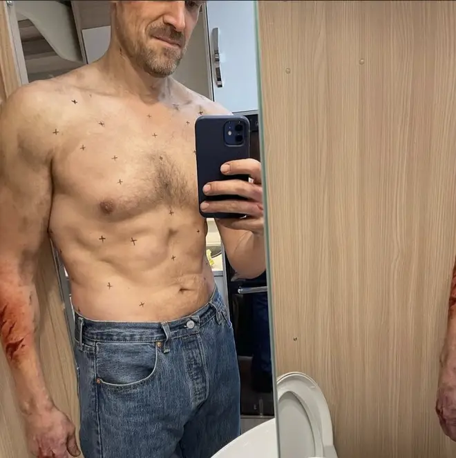 David Harbour reveals Hopper's scars on his torso were CGI