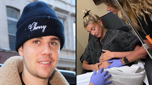 Justin Bieber baby Hailey Baldwin pregnant ultrasound April Fool's joke