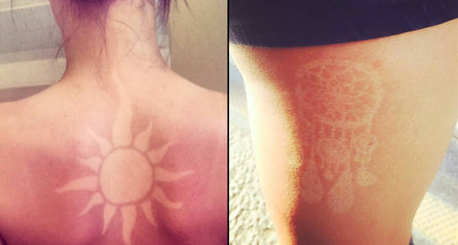 People are giving themselves sunburn tattoos and it's SO dangerous - PopBuzz