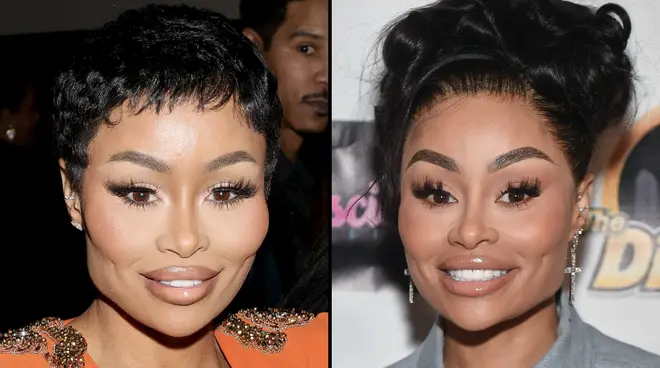 Blac Chyna shows off face transformation after getting her fillers dissolved