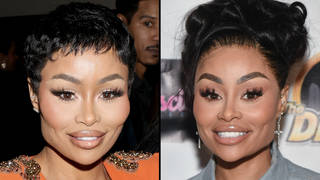 Blac Chyna shows off face transformation after getting her fillers dissolved