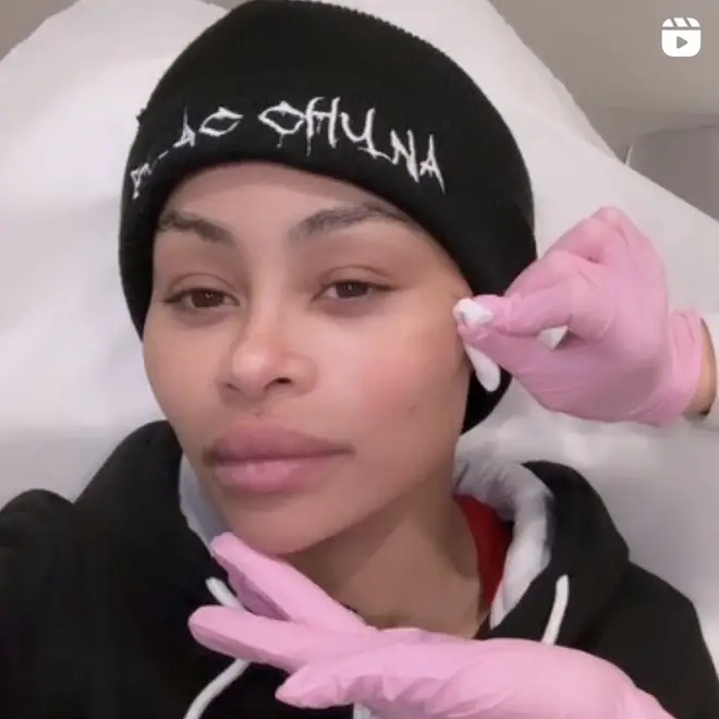 Blac Chyna has been documenting her "life-changing journey" removing her fillers