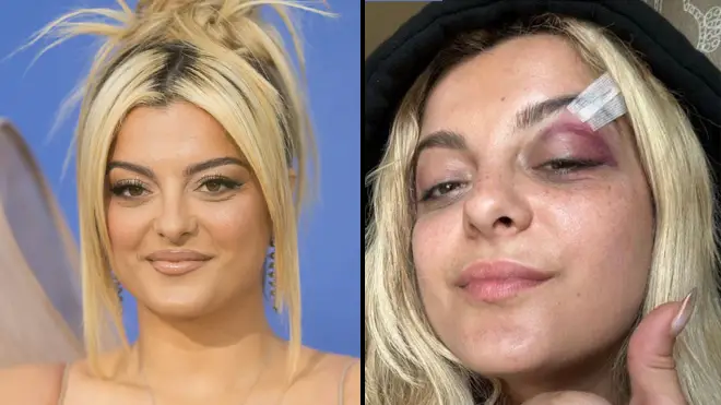 Bebe Rexha fan says he threw a phone at her because he thought it would be "funny"