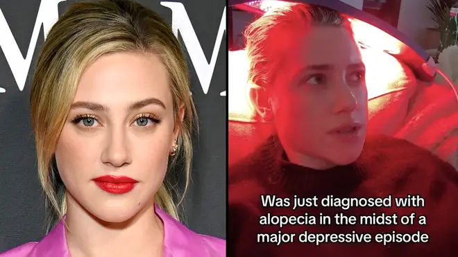 Lili Reinhart receives support after sharing her alopecia diagnosis