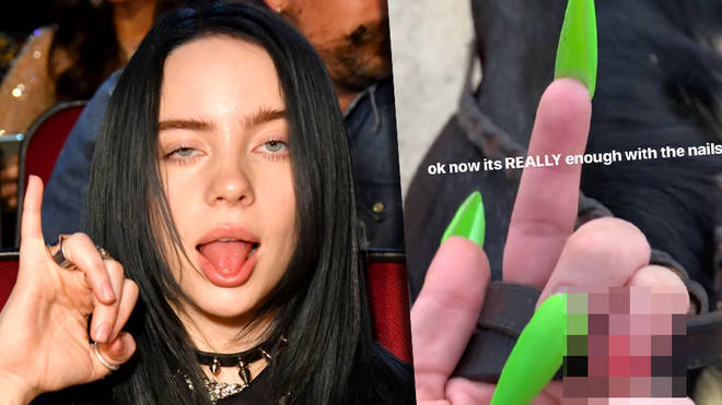 Billie EIlish nail: How did she rip off her fingernail?