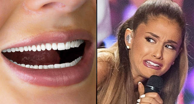 HiSmile teeth, Ariana Grande Victoria Secret Fashion Show.
