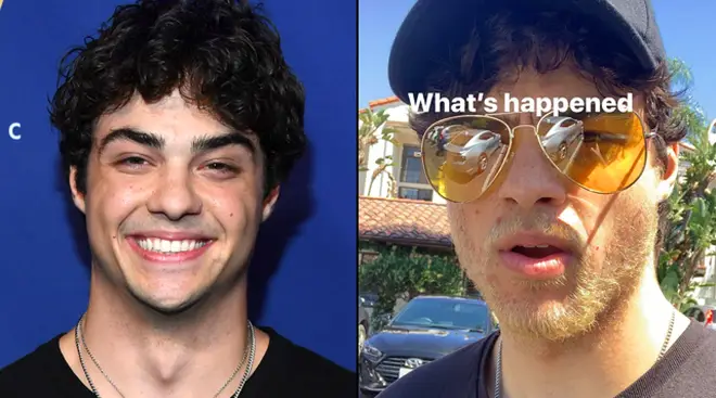 Noah Centineo shows his bleached facial hair on Instagram