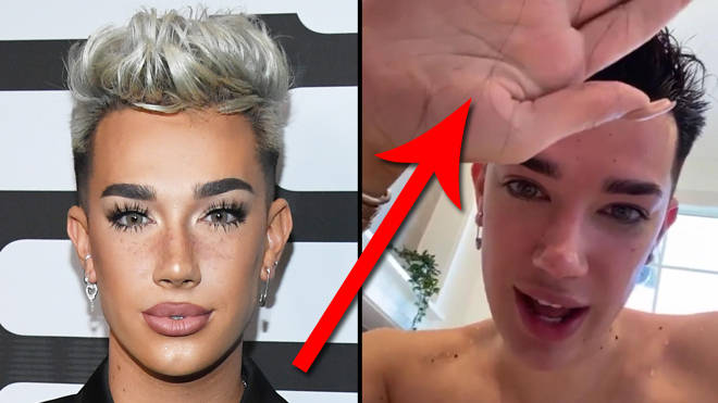 James Charles reveals hair loss due to bleaching in shocking video