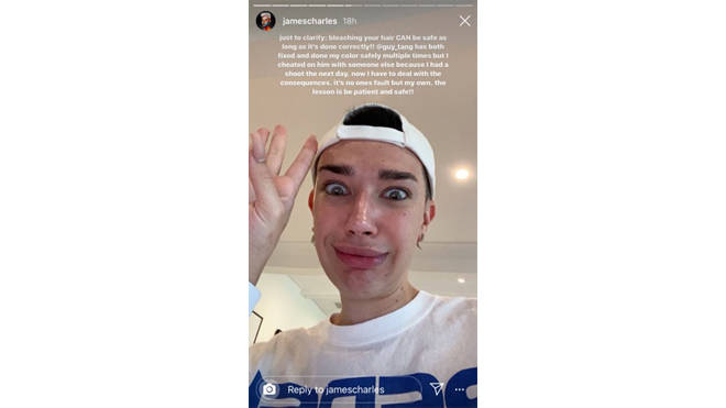 James Charles clarifies hair loss and bleaching comments on Instagram